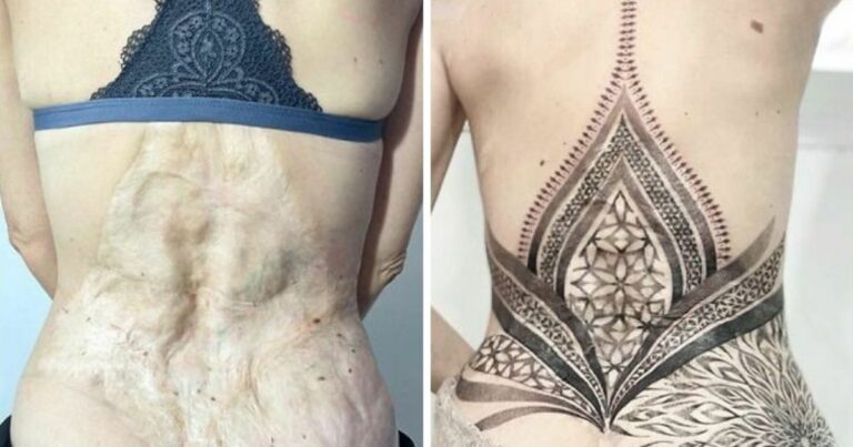 20 Times Tattoo Artists Did Amazing Cover Ups For Birthmarks and Scars